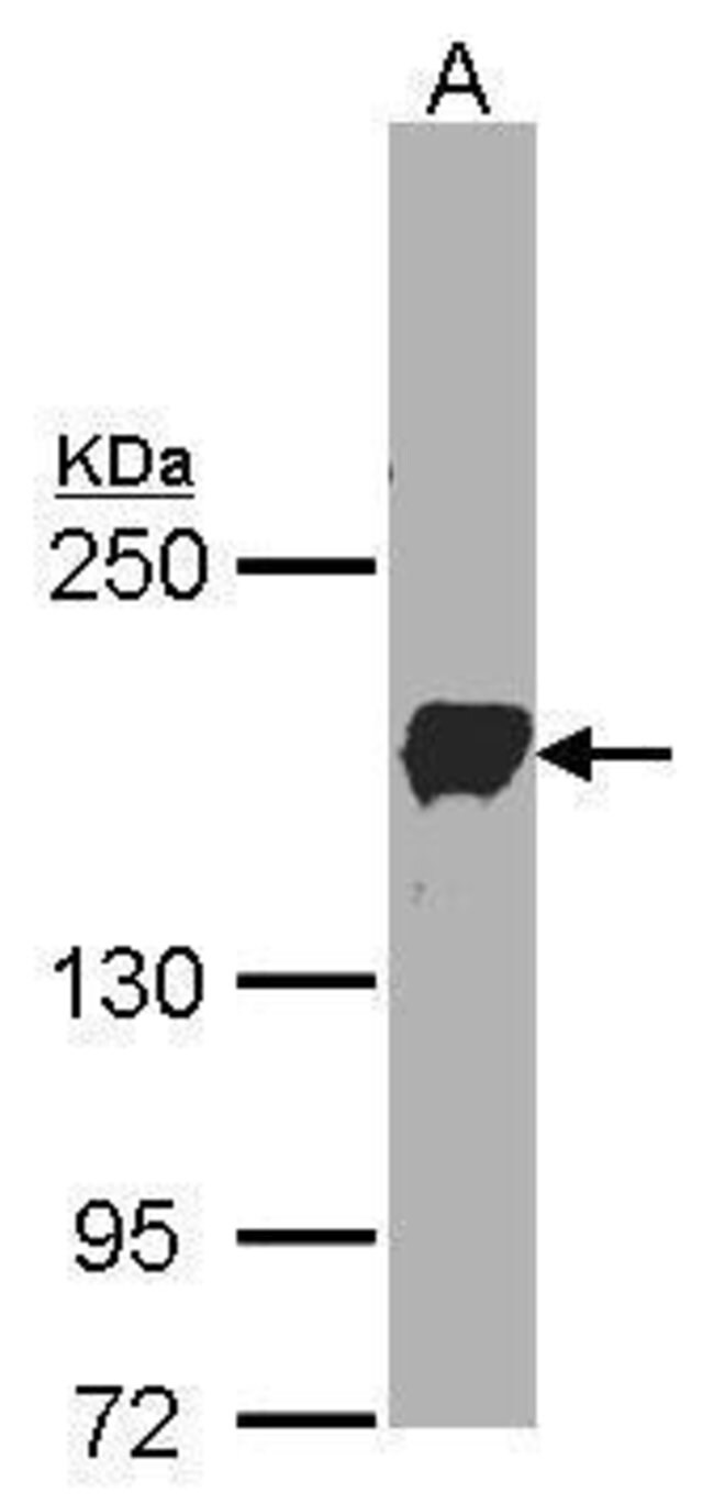 ANTI-PCDH1