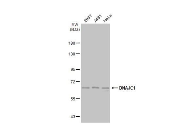 Anti-DNAJC1