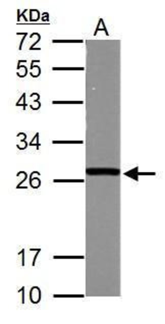 Anti-GSTM5