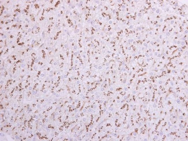 Anti-CD75