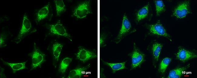 ANTI-PYRUVATE DEHYDROGENASE E1 BETA SUBU