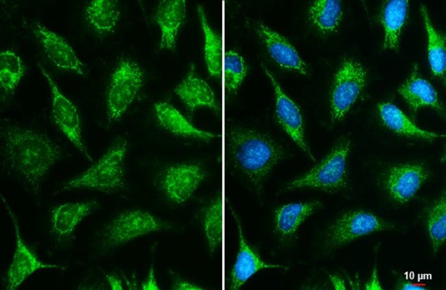 Anti-IDH3A