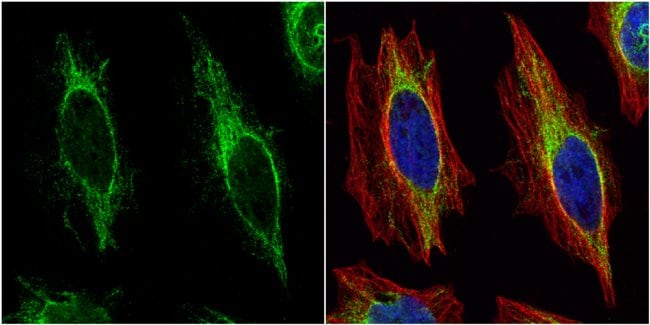 Anti-Cytokeratin 14