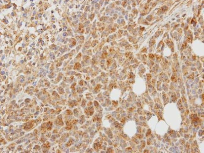 Anti-PCPE-1