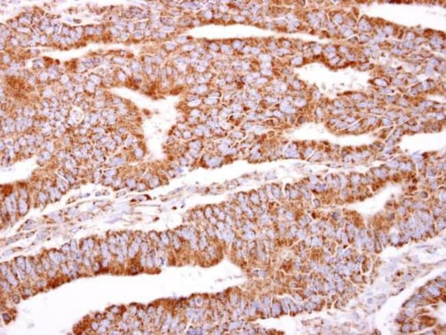 Anti-PACSIN2