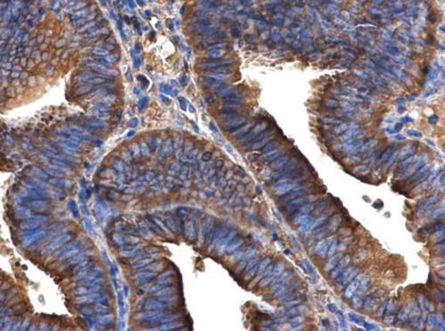 Anti-ARFIP2