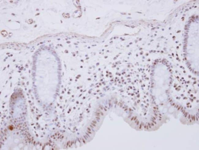 Anti-RCL1