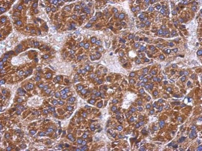 Anti-C4 binding protein B