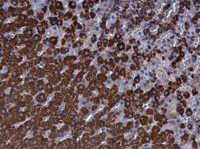 Anti-Ferredoxin Reductase
