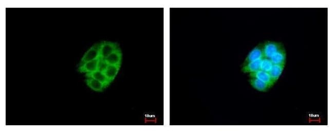 Anti-Carboxylesterase 2