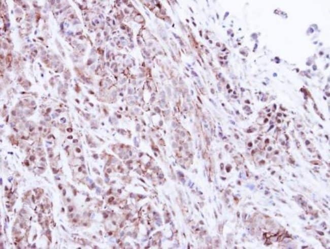 Anti-Proteasome 20S alpha 1
