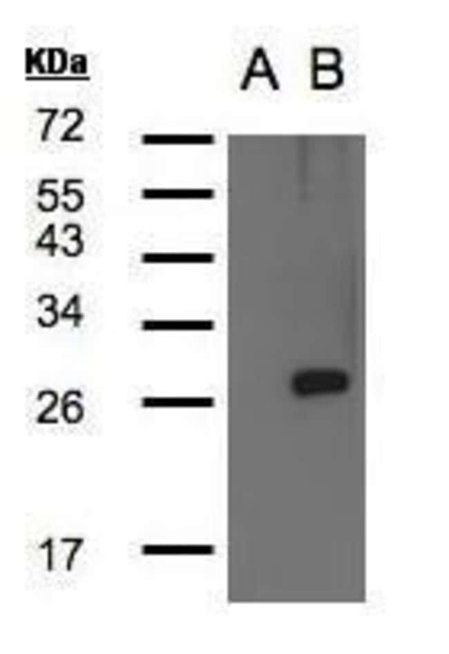 Anti-LYPLA1