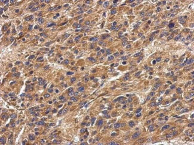 ANTI-HLA-DPA1