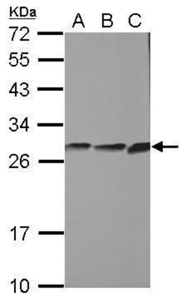 Anti-CYB5R2