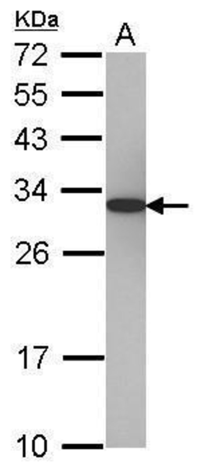 Anti-PSME1