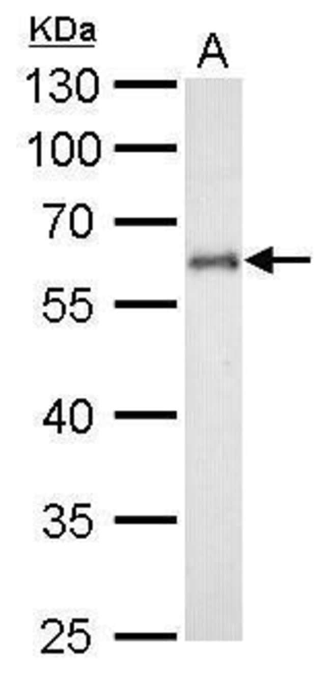 Anti-Cytochrome P450 1B1