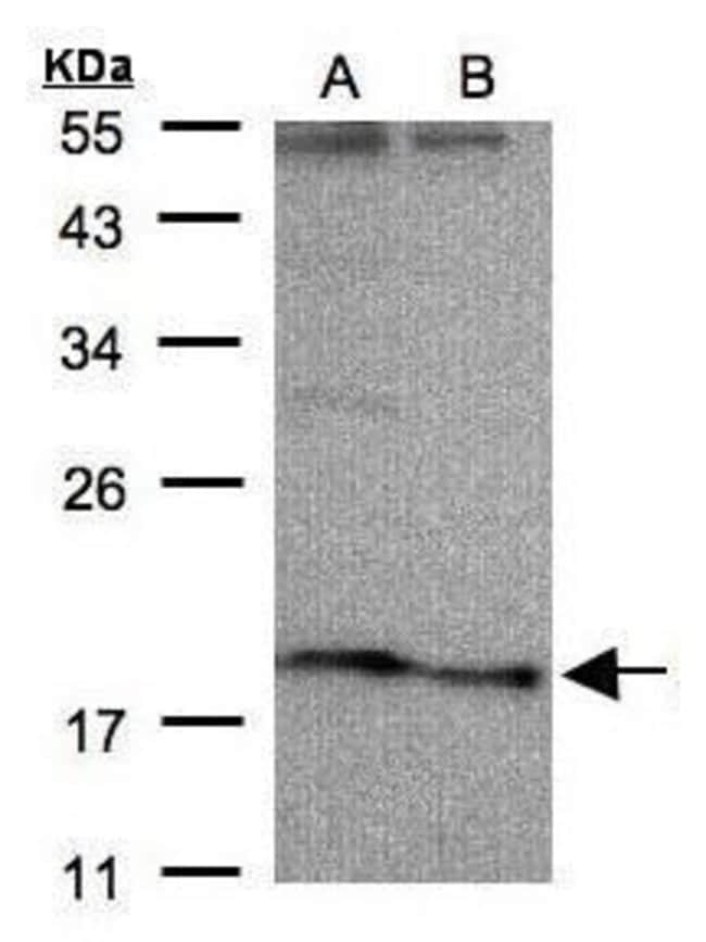 Anti-SCN3B
