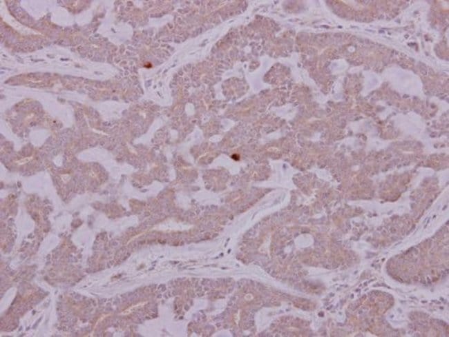 Anti-PCYT2