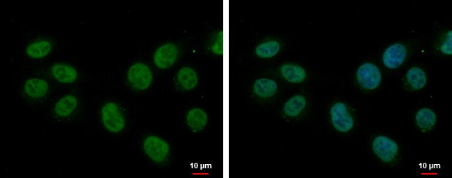 Anti-splicing factor 1