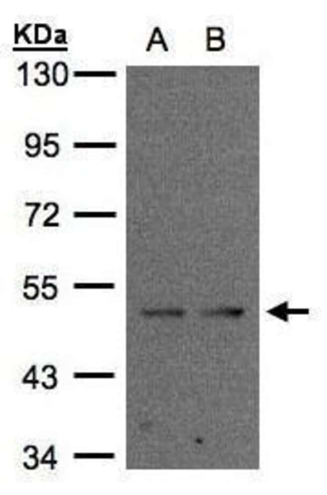 Anti-IFRD1