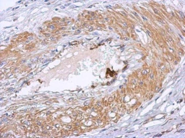 Anti-Dystrobrevin beta