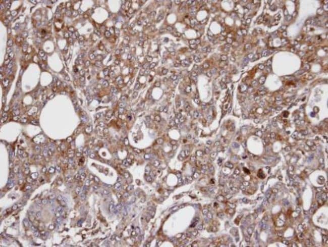 Anti-AKR1C3