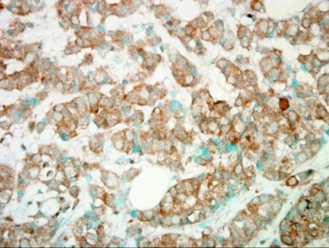 Anti-PI3 kinase p110 gamma