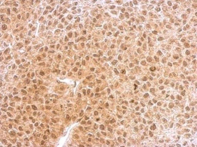 Anti-RNF25