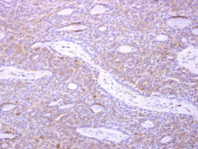 Anti-p41-ARCb