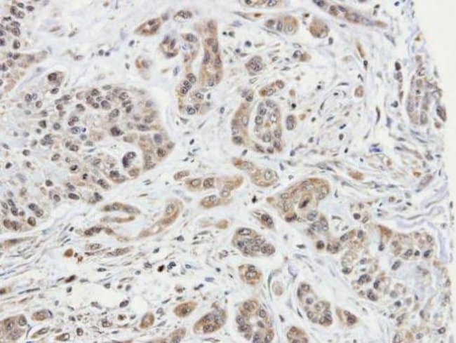 Anti-ARPC1A