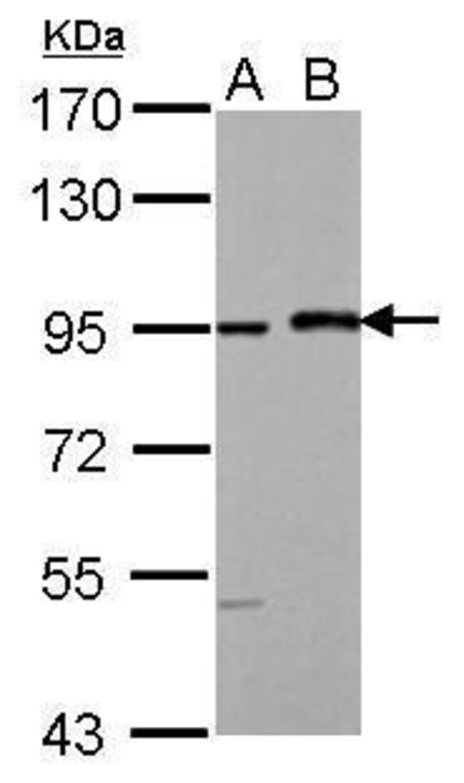 Anti-MAML1