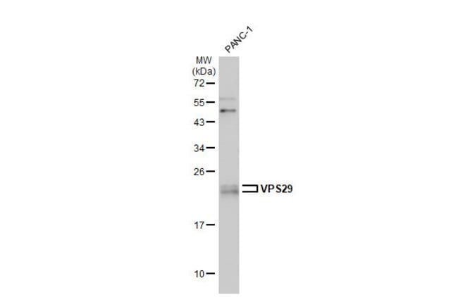 Anti-VPS29