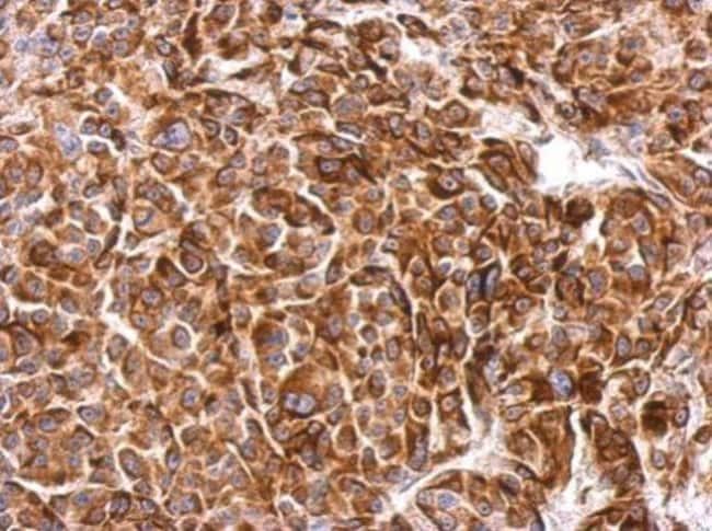 Anti-SIPA1