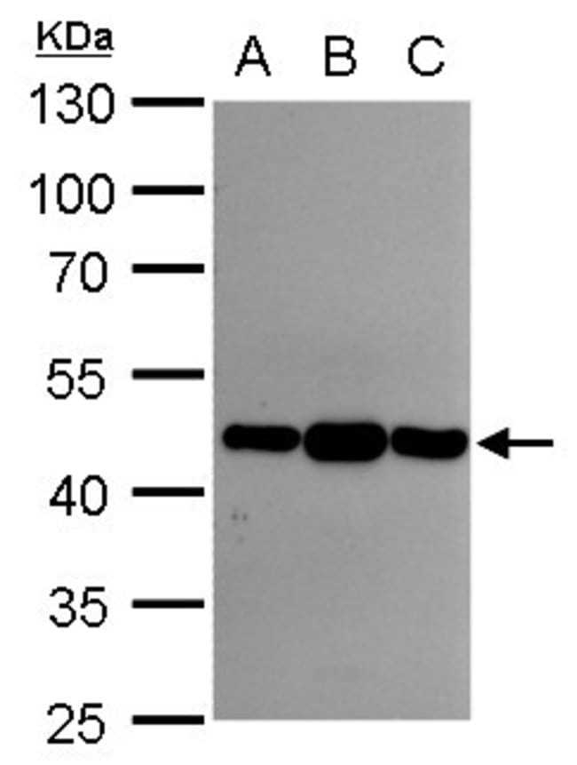 Anti-Asporin