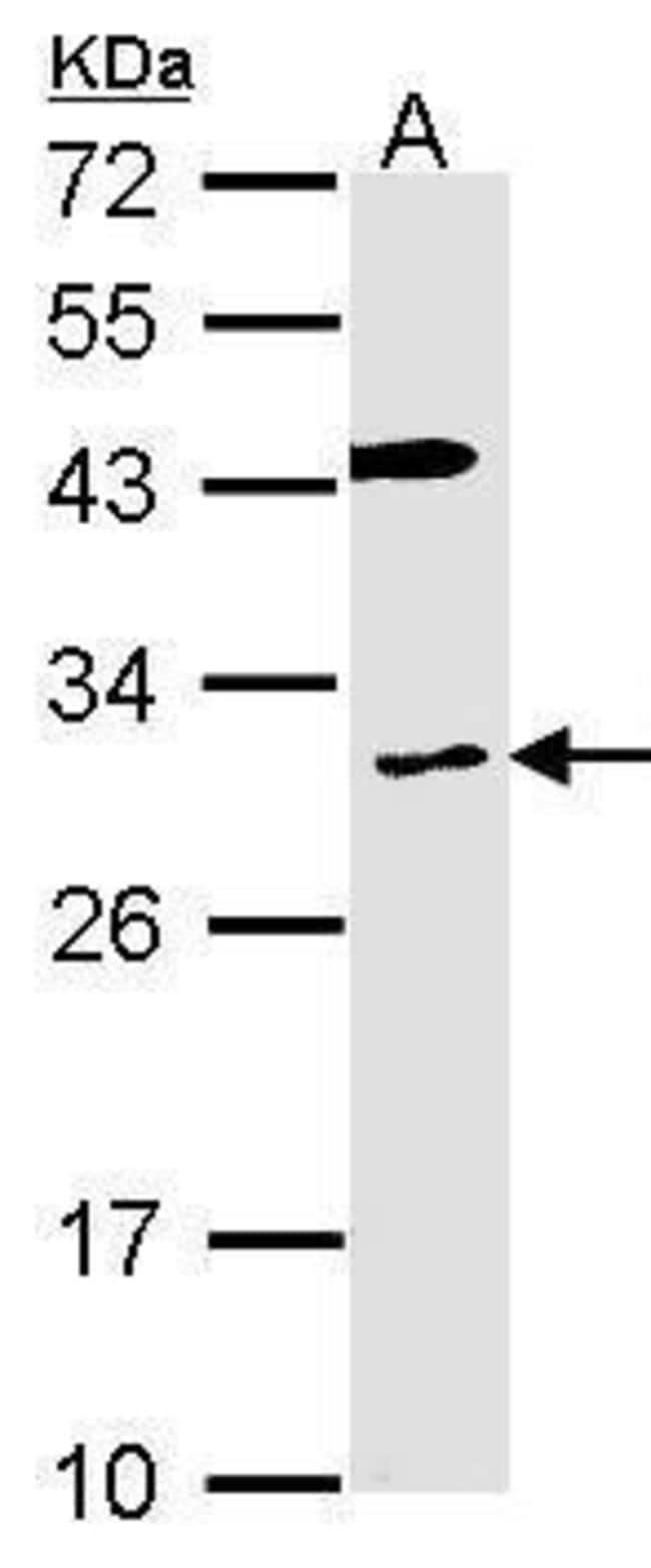 Anti-Cytochrome b reductase 1