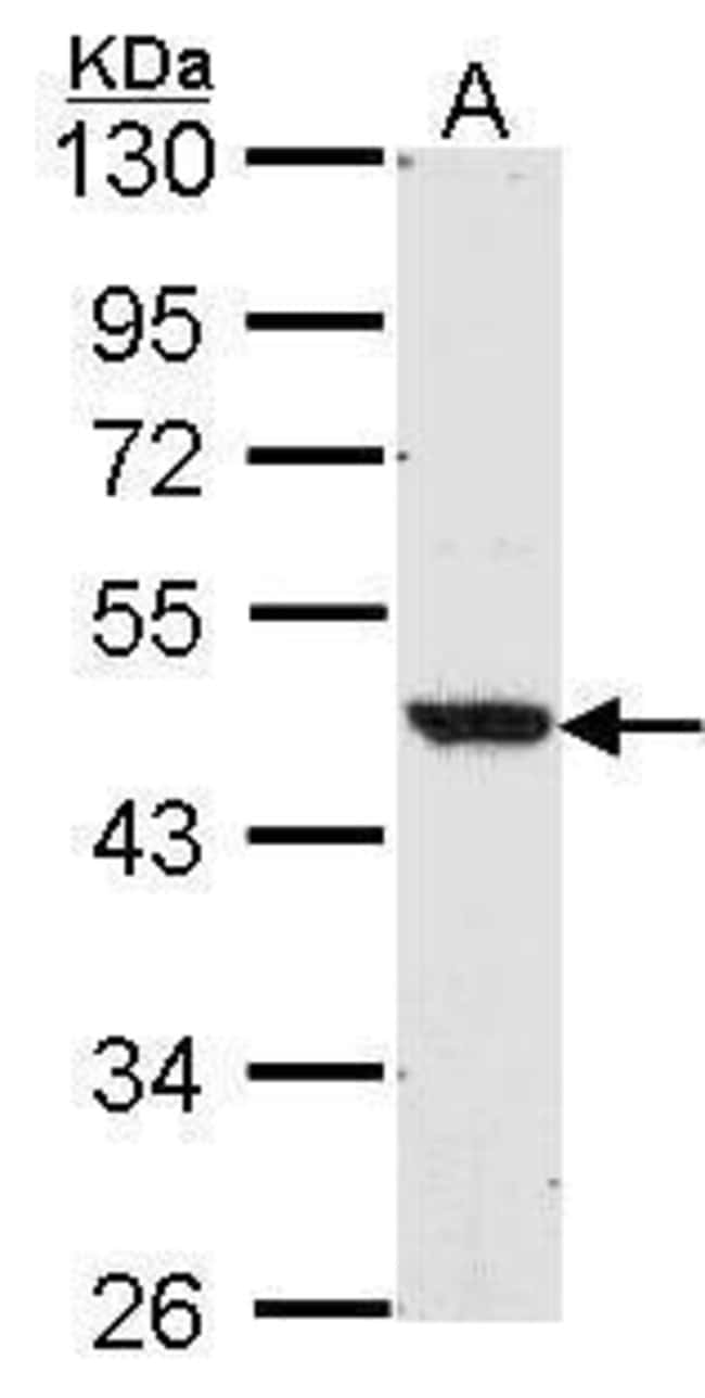 Anti-LXR beta