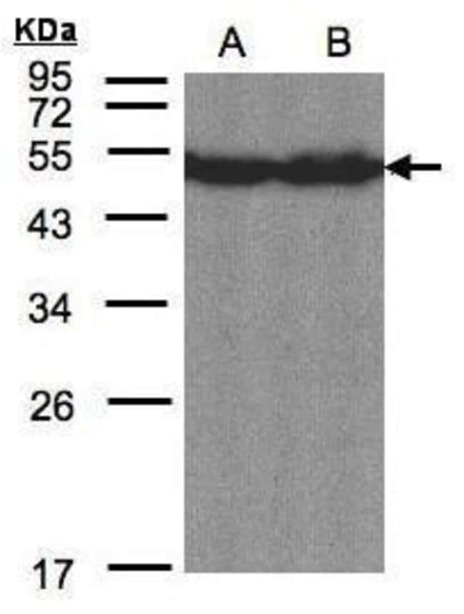 Anti-CREB3L1