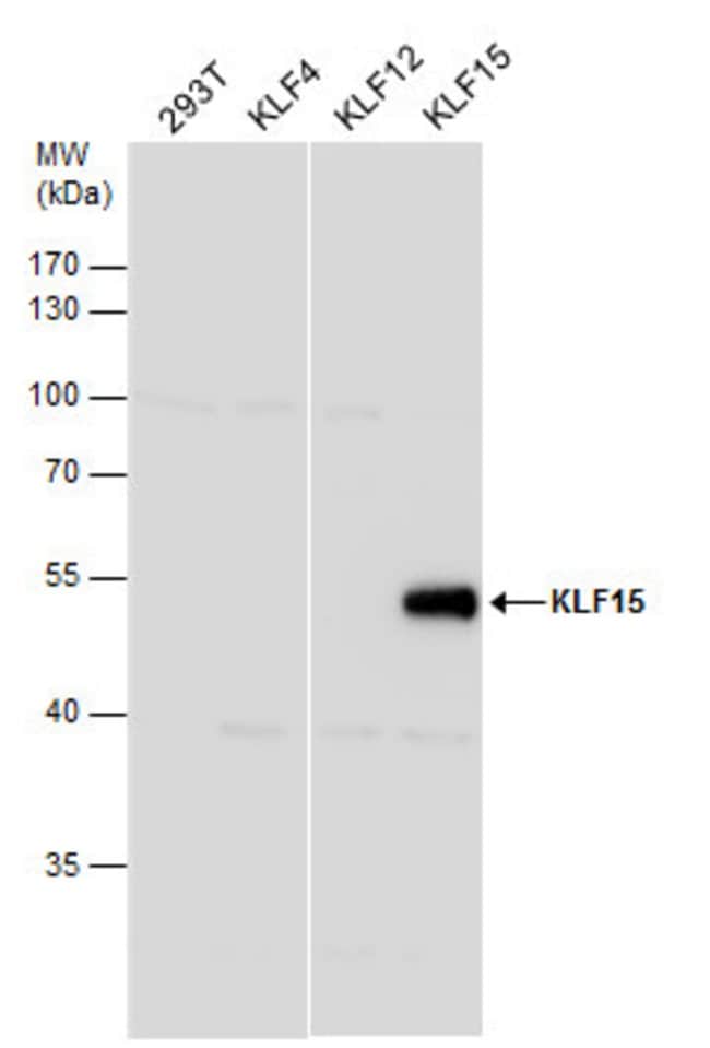 Anti-KLF15