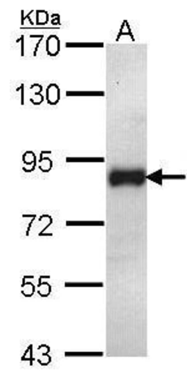 Anti-ILF1