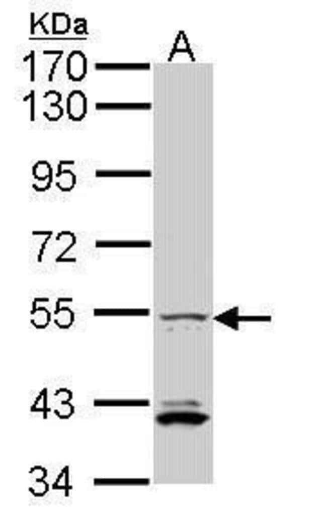 Anti-IRF5