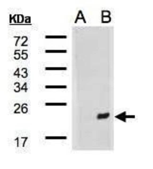 Anti-MDG1