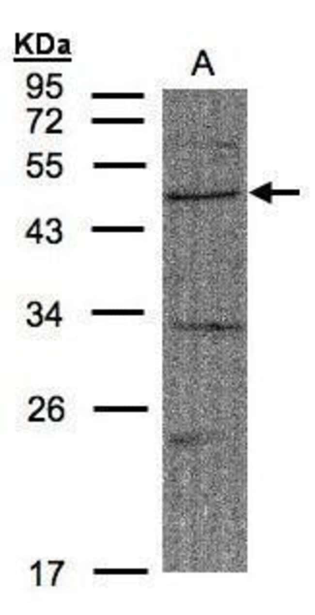 Anti-FBXW2