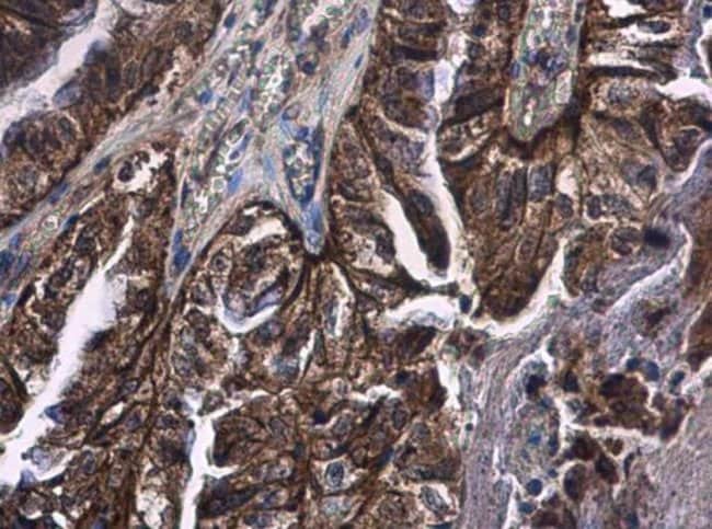 Anti-CD89