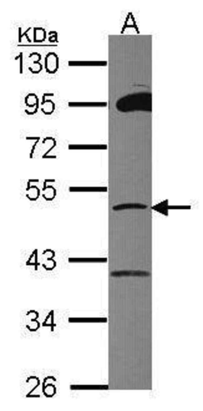 Anti-ZNF38