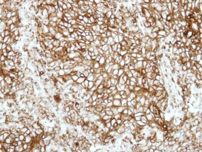 Anti-HLA-DRB1