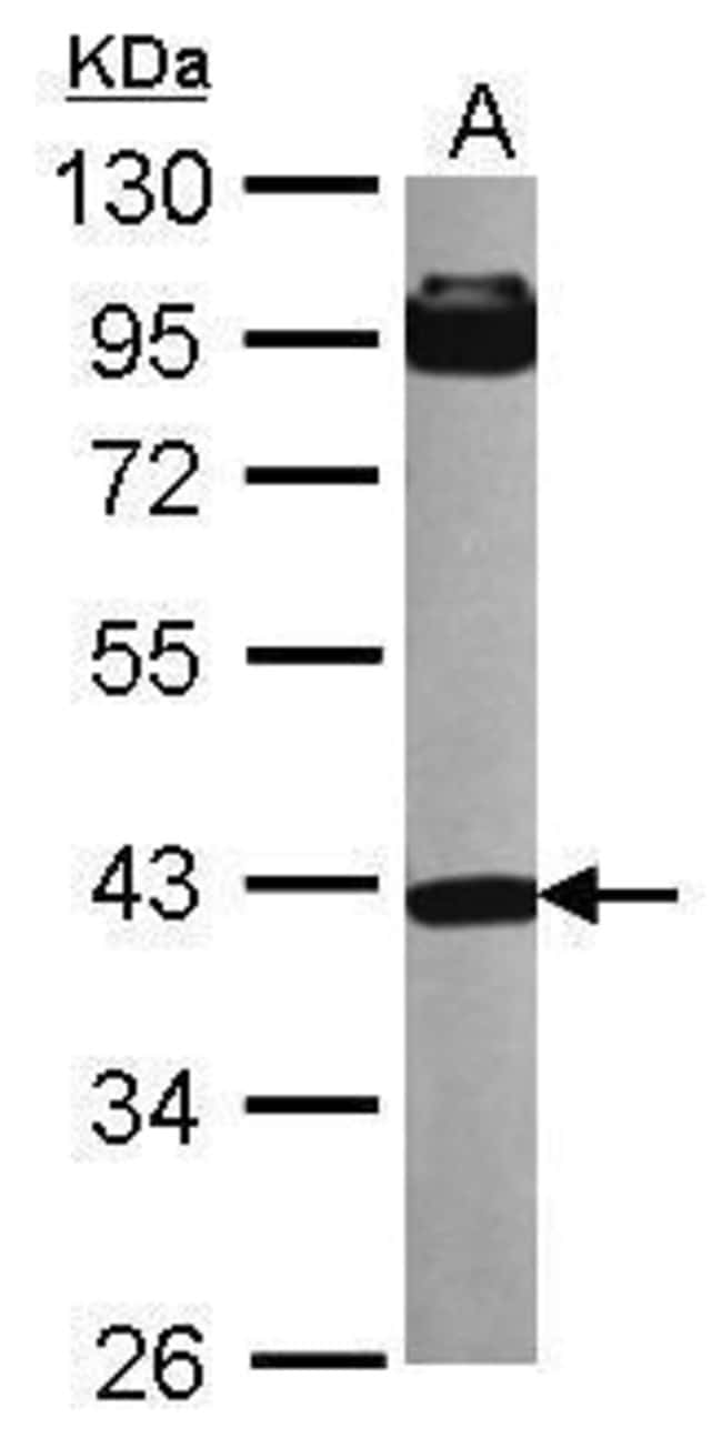 Anti-INPP5A