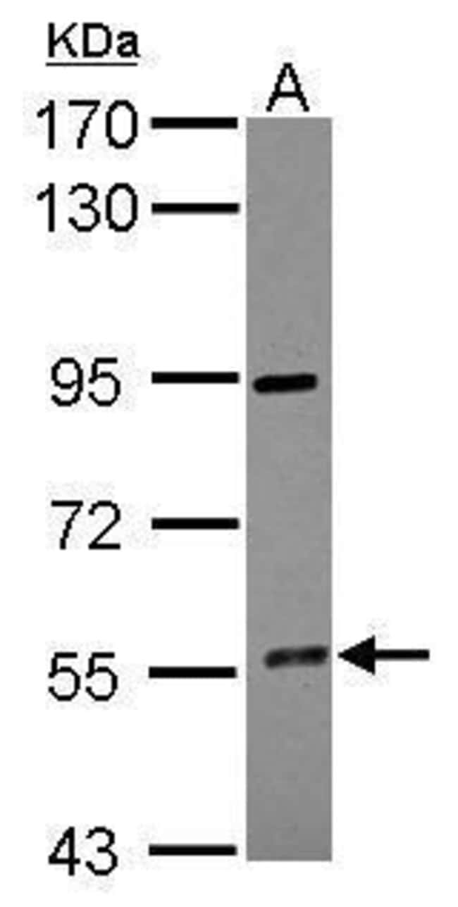 Anti-CYP4F12