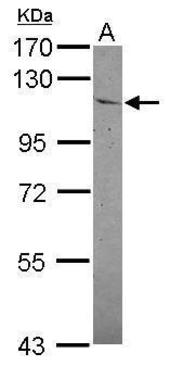 Anti-insulin degrading enzyme