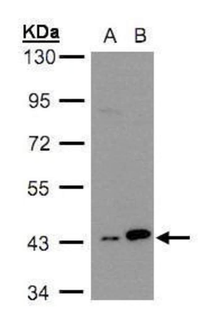 Anti-MAPKAP Kinase 3