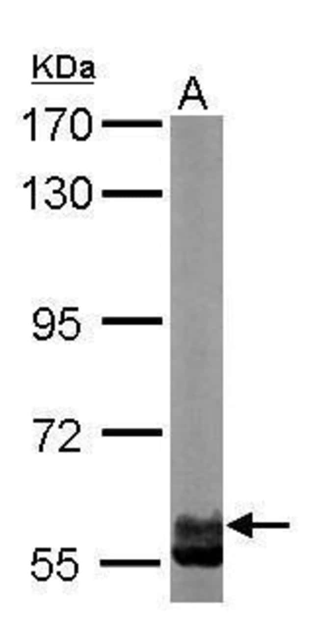 Anti-TCP1 zeta